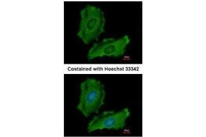 ICC/IF Image Immunofluorescence analysis of methanol-fixed HeLa, using PTPN12, antibody at 1:200 dilution. (PTPN12 Antikörper  (N-Term))