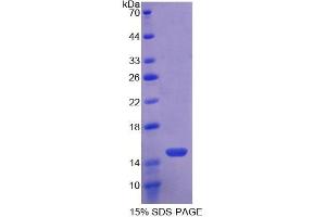 SDS-PAGE analysis of Mouse Toll Like Receptor 3 Protein. (TLR3 Protein)