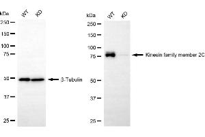 anti-Kinesin Family Member 2C (KIF2C) antibody