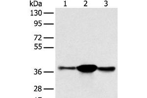 Western blot analysis of K562 A375 and 231 cell using SPRY4 Polyclonal Antibody at dilution of 1:400 (SPRY4 Antikörper)