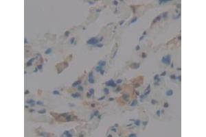 IHC-P analysis of Human Tissue, with DAB staining. (Vitronectin Antikörper  (AA 400-468))