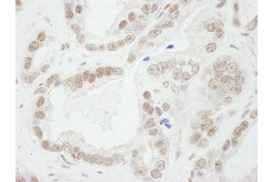 Immunohistochemistry (IHC) image for anti-Budding Uninhibited By Benzimidazoles 3 Homolog (Yeast) (BUB3) (AA 275-325) antibody (ABIN7448449) (BUB3 Antikörper  (AA 275-325))