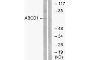 Western blot analysis of extracts from Jurkat cells, using ABCD1 Antibody. (ABCD1 Antikörper  (AA 531-580))
