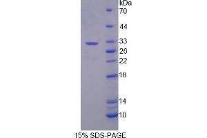 Image no. 1 for Cathepsin A (CTSA) (AA 171-417) protein (His tag) (ABIN6238370) (CTSA Protein (AA 171-417) (His tag))