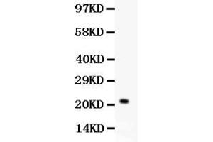 Western blot analysis of IL-18 expression in HELA whole cell lysates ( Lane 1).