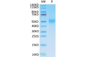 SDS-PAGE (SDS) image for CD80 (CD80) (AA 38-246) protein (His tag) (ABIN7273895)