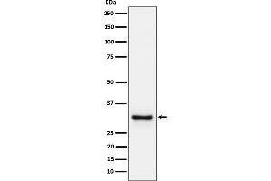 Western blot analysis of Adiponectin expression in human plasma cell lysate.
