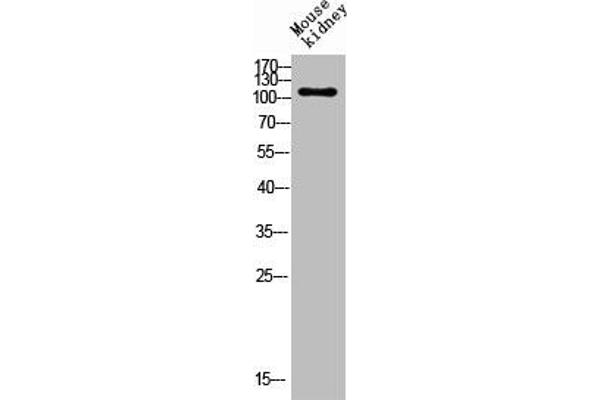 ENPP3 Antikörper  (Internal Region)