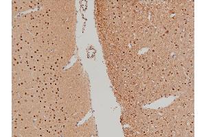 Immunohistochemistry (IHC) image for anti-LIM Domain Kinase 1 (LIMK1) (pThr508) antibody (ABIN6255701)