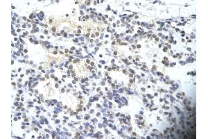 Rabbit Anti-SIRT3 Antibody       Paraffin Embedded Tissue:  Human alveolar cell   Cellular Data:  Epithelial cells of renal tubule  Antibody Concentration:   4. (SIRT3 Antikörper  (C-Term))