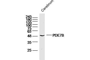 Mouse cerebrum lysates probed with PDE7B Polyclonal Antibody, unconjugated  at 1:300 overnight at 4°C followed by a conjugated secondary antibody at 1:10000 for 90 minutes at 37°C. (PDE7B Antikörper  (AA 281-360))