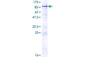 PGM2L1 Protein (AA 1-622) (GST tag)