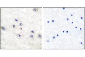 Immunohistochemistry analysis of paraffin-embedded human brain tissue, using COT (Ab-290) Antibody. (CROT Antikörper  (AA 256-305))