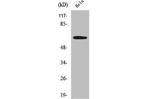 Western Blot analysis of HeLa cells using Sgo1 Polyclonal Antibody (Shugoshin Antikörper  (Internal Region))