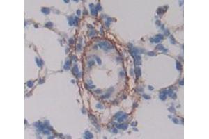 Used in DAB staining on fromalin fixed paraffin- embedded lung tissue (MCAM Antikörper  (AA 323-560))