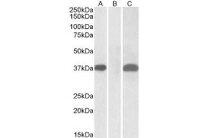 HEK293 lysate (10ug protein in RIPA buffer) overexpressing Human PIM2 with C-terminal MYC tag probed with ABIN5539749 (1ug/ml) in Lane A and probed with anti-MYC Tag (1/1000) in lane C.