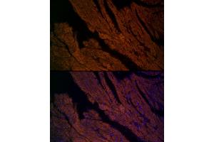 Immunofluorescence analysis of mouse heart cells using RYR2 Rabbit pAb (ABIN1513493, ABIN3020906, ABIN3020907 and ABIN6213787) at dilution of 1:200 (40x lens). (RYR2 Antikörper  (AA 4850-4950))