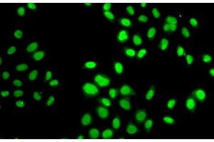 Immunofluorescence analysis of MCF7 cells using GPS1 Polyclonal Antibody (GPS1 Antikörper)
