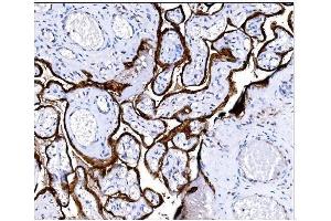 IHC analysis of Steroid Sulfatase/STS using anti-Steroid Sulfatase/STS antibody (ABIN7601166). (STS Antikörper  (AA 297-547))