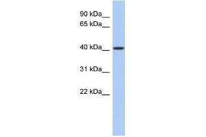 WB Suggested Anti-LASS5 Antibody Titration:  0. (LASS5 Antikörper  (N-Term))