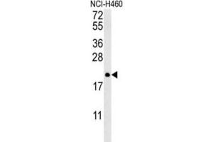 Western Blotting (WB) image for anti-Protein tyrosine Phosphatase Type IVA, Member 2 (PTP4A2) antibody (ABIN3002826) (PTP4A2 Antikörper)