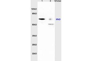 Lane 1: mouse liver (hepatitis) lysates Lane 2: rat liver lysates probed with Anti Hepatitis C Virus RNA-directed RNA polymerase Polyclonal Antibody, Unconjugated (ABIN1385126) at 1:200 in 4 °C. (HCV RdRP Antikörper  (AA 2501-2600))