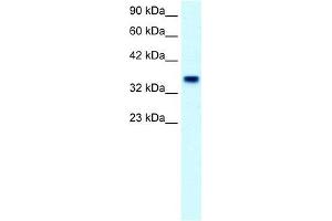Human Placenta; WB Suggested Anti-FOXF1 Antibody Titration: 2. (FOXF1 Antikörper  (C-Term))