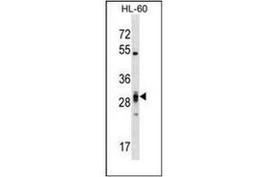 Western blot analysis of PLEKHF2 Antibody (Center) in HL-60 cell line lysates (35ug/lane). (PLEKHF2 Antikörper  (Middle Region))