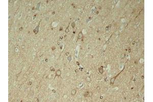 Immunohistochemical analysis of paraffin-embedded rat hippocampal region tissue from a model with Alzheimer (MAPT Antikörper  (pSer396))