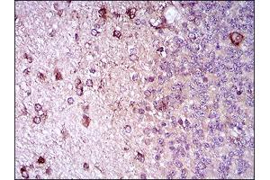 Immunohistochemistry (IHC) image for anti-CD22 Molecule (CD22) (AA 621-725) antibody (ABIN1724888)