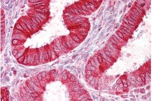ABIN570696 (2. (SCNN1D Antikörper  (C-Term))
