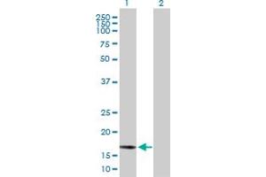 Western Blot analysis of BCL2L2 expression in transfected 293T cell line by BCL2L2 MaxPab polyclonal antibody. (BCL2L2 Antikörper  (AA 1-193))