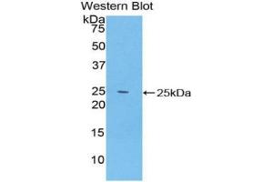 Western blot analysis of the recombinant protein. (SPRY2 Antikörper  (AA 116-305))