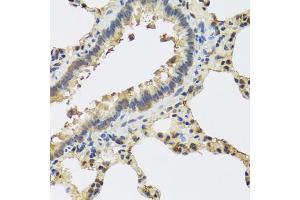 Immunohistochemistry of paraffin-embedded rat lung using IL25 antibody (ABIN5974535) at dilution of 1/100 (40x lens). (IL-25 Antikörper)