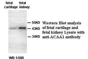 Image no. 2 for anti-Acetyl-CoA Acyltransferase 1 (ACAA1) antibody (ABIN791175)