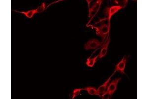 Immunofluorescence (fixed cells) (IF/ICC) image for anti-Prostaglandin Reductase 2 (PTGR2) (Internal Region) antibody (ABIN6257815)