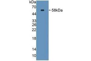 SPTLC3 Antikörper  (AA 80-563)