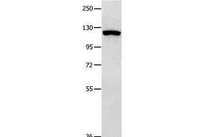 Western Blot analysis of 823 cell using MVP Polyclonal Antibody at dilution of 1:350