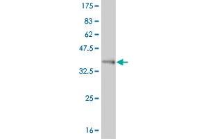 Western Blot detection against Immunogen (37. (FOXL1 Antikörper  (AA 132-240))