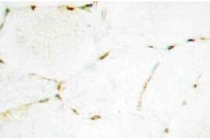 Immunohistochemistry (IHC) analyzes of Smad1/5/9 antibody in paraffin-embedded human skeletal muscle tissue. (SMAD1 Antikörper)