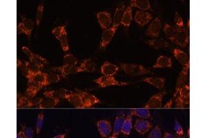 Immunofluorescence analysis of NIH-3T3 cells using UBE2F Polyclonal Antibody at dilution of 1:100. (UBE2F Antikörper)