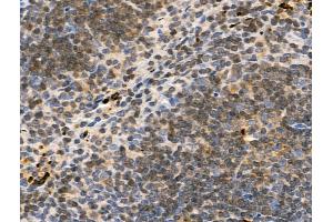 ABIN7093305 and ABIN7097324 at 1/100 staining Mouse spleen tissue by IHC-P. (TCP1 alpha/CCTA Antikörper  (pSer395))
