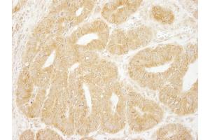 Immunohistochemistry (IHC) image for anti-Eukaryotic Translation Initiation Factor 2A, 65kDa (EIF2A) (AA 525-575) antibody (ABIN7448543)