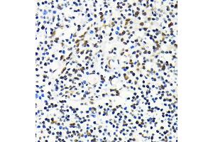 Immunohistochemistry of paraffin-embedded human tonsil using MKL1 antibody (ABIN6132380, ABIN6143855, ABIN6143858 and ABIN6224589) at dilution of 1:100 (40x lens).