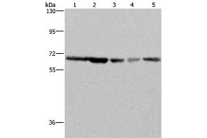 Western Blot analysis of K562, Hela, LoVo, 293T and Raji cell using GNL3 Polyclonal Antibody at dilution of 1:300 (Nucleostemin Antikörper)
