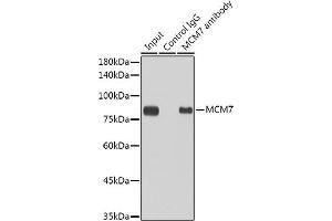 Immunoprecipitation analysis of 300 μg extracts of HeLa cells using 3 μg MCM7 antibody (ABIN7268544). (MCM7 Antikörper)