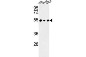 Western Blotting (WB) image for anti-Protein Phosphatase 1, Regulatory Subunit 36 (PPP1R36) antibody (ABIN3003992) (PPP1R36 Antikörper)