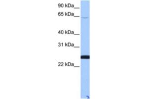 Western Blotting (WB) image for anti-Zinc Finger Protein 570-like (LOC344065) antibody (ABIN2463395) (ZFP 570-like Antikörper)