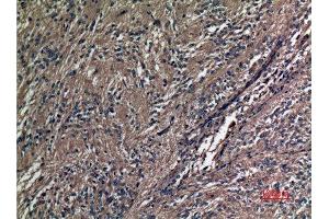 Immunohistochemistry (IHC) analysis of paraffin-embedded Human Ovary, antibody was diluted at 1:100.