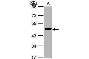 WB Image Sample(30 ug whole cell lysate) A:MOLT4 , 10% SDS PAGE antibody diluted at 1:1000 (MEK2 Antikörper)